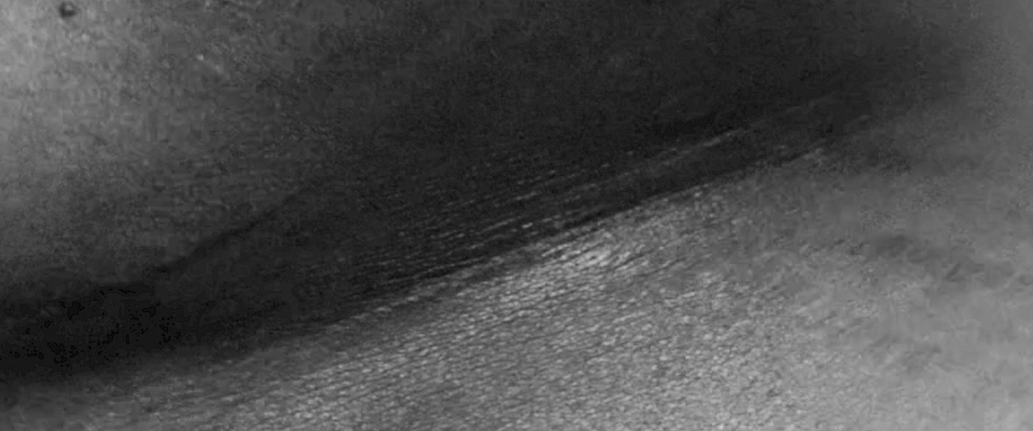 Eine detaillierte Schwarz-Weiß-Nahaufnahme zeigt die Haut einer Person mit Schatten und Narben.