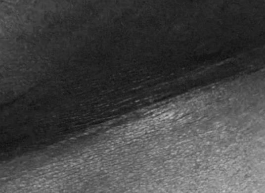 Eine detaillierte Schwarz-Weiß-Nahaufnahme zeigt die Haut einer Person mit Schatten und Narben.